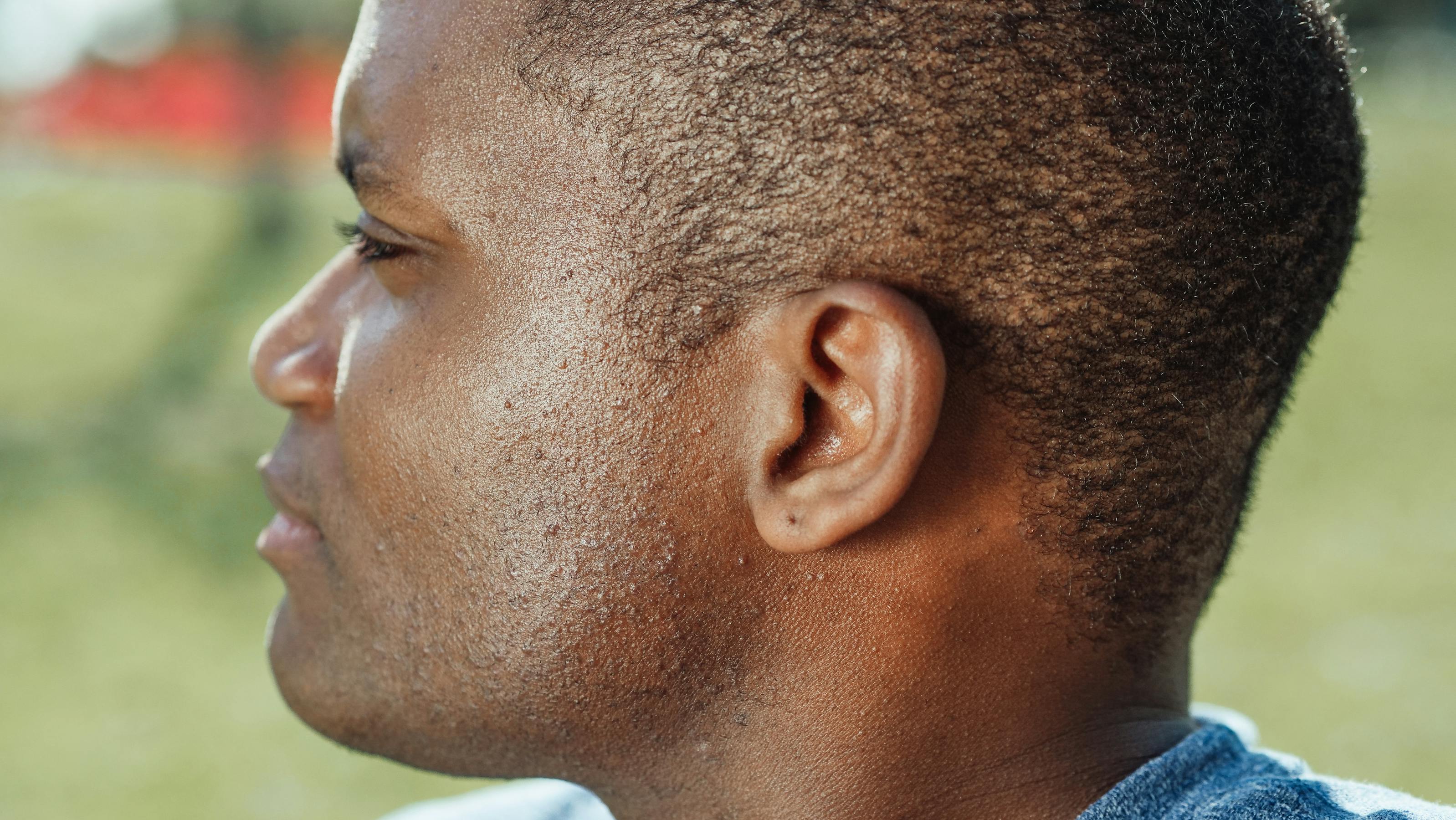 Gros plan sur une oreille, illustrant la discrétion des appareils auditifs invisibles placés dans le conduit